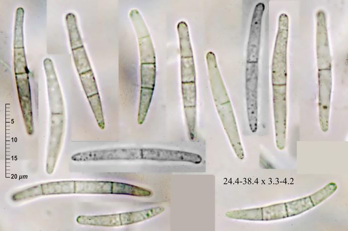 macrostoma