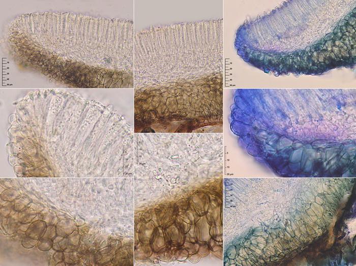 macrostoma