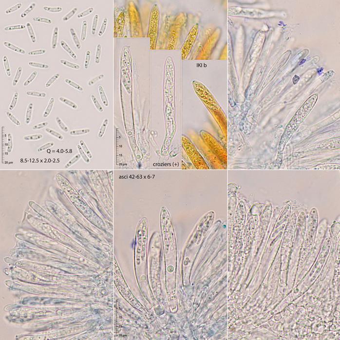 macrostoma