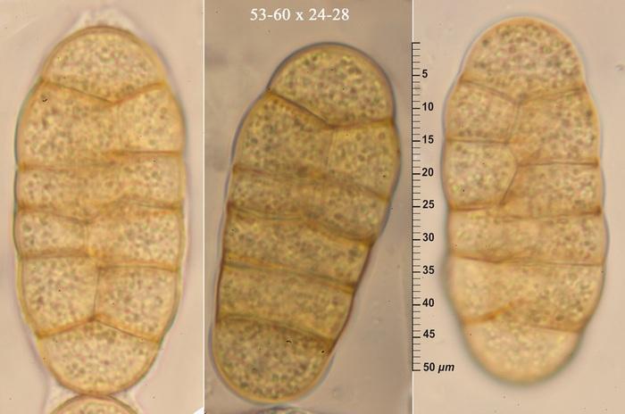 macrostoma