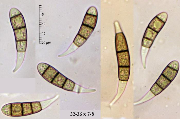 macrostoma