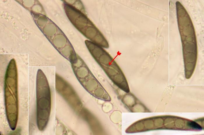 macrostoma
