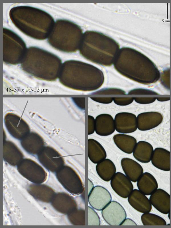 macrostoma