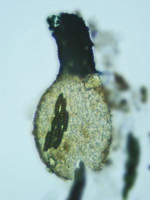 macrostoma