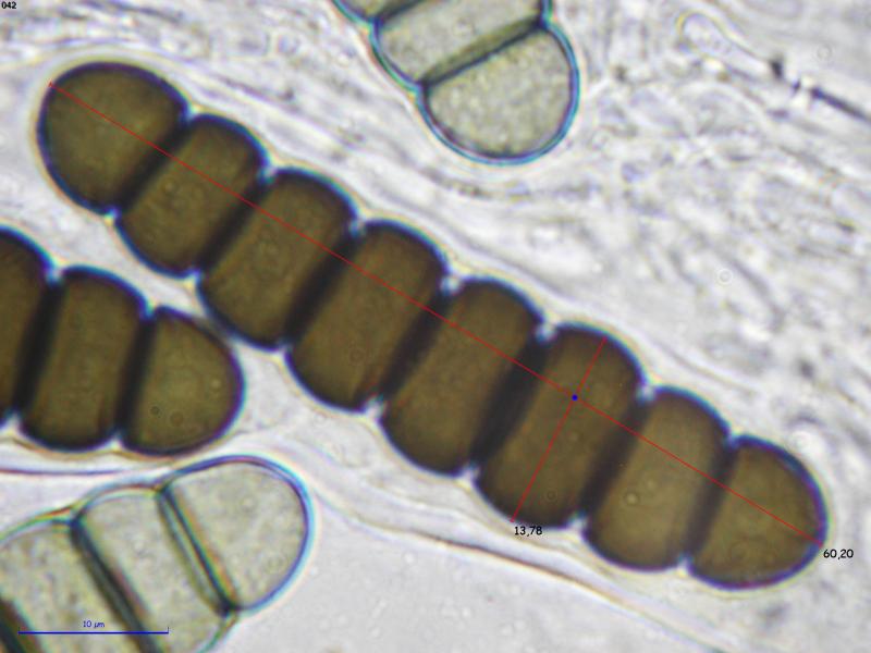 macrostoma