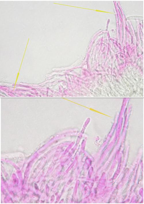 macrostoma