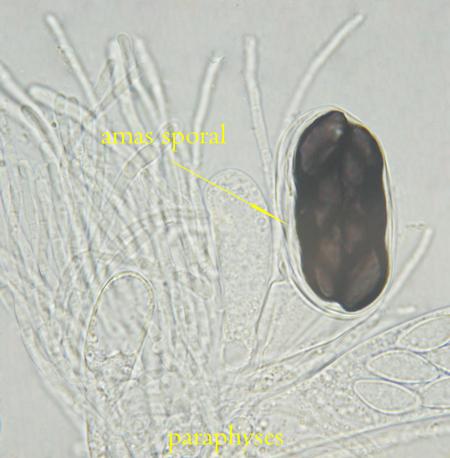 macrostoma