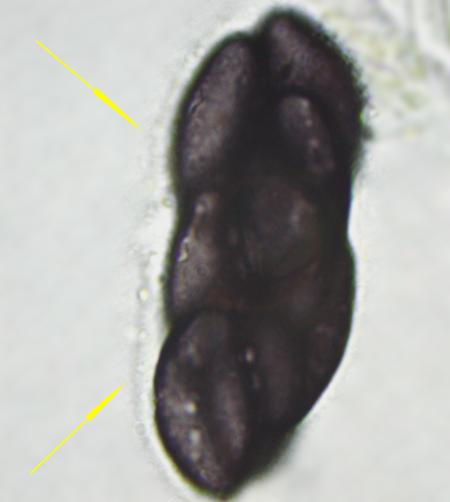 macrostoma