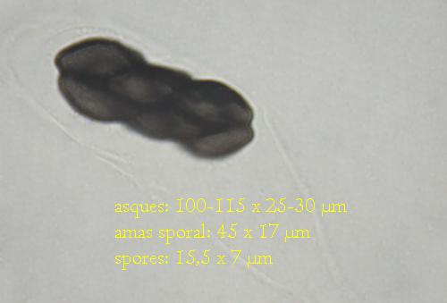 macrostoma
