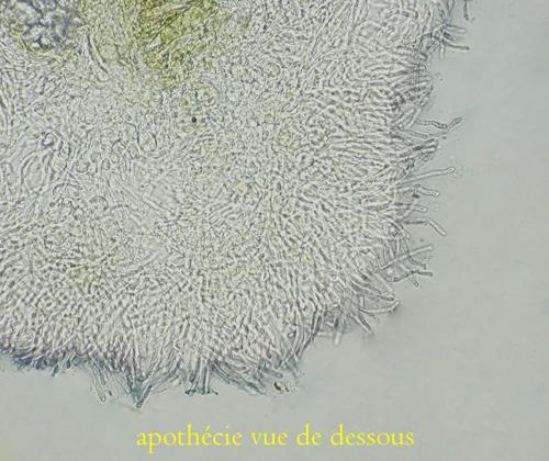 macrostoma