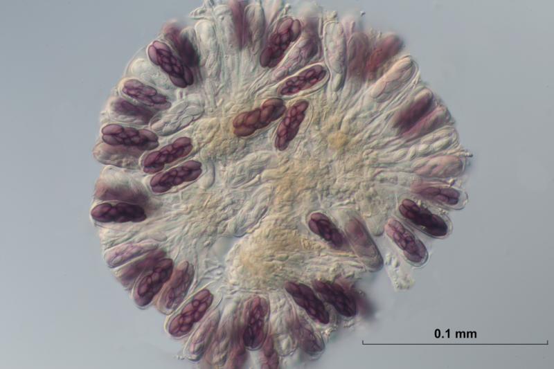 macrostoma