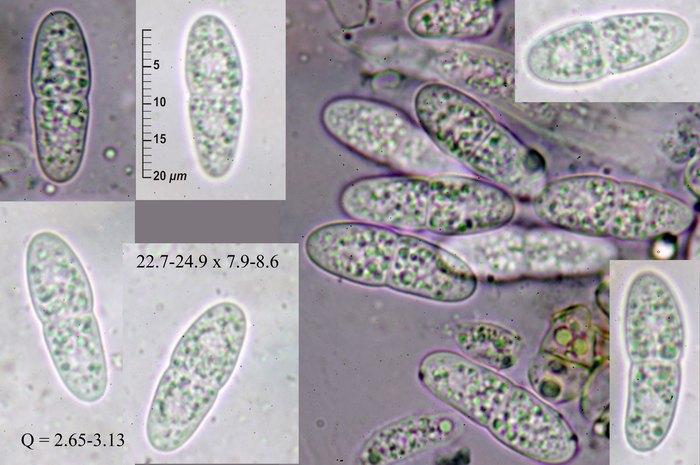 macrostoma
