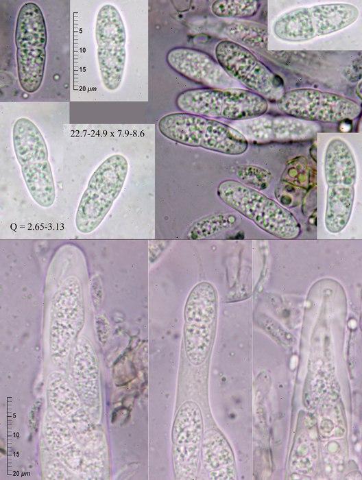 macrostoma