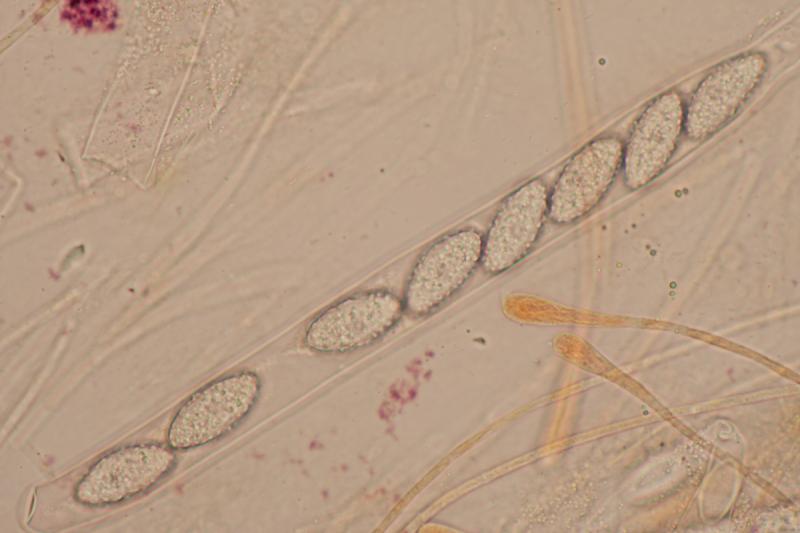 macrostoma