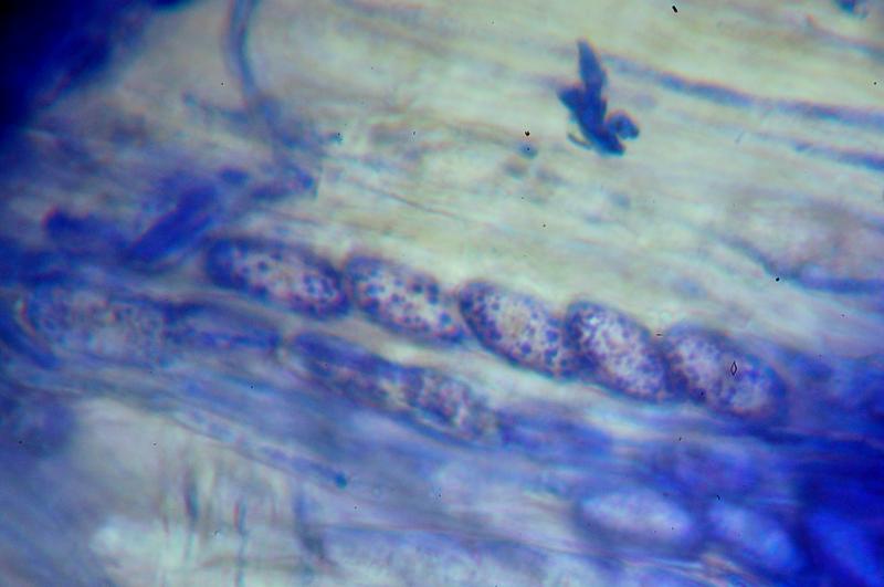macrostoma
