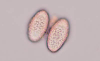 macrostoma