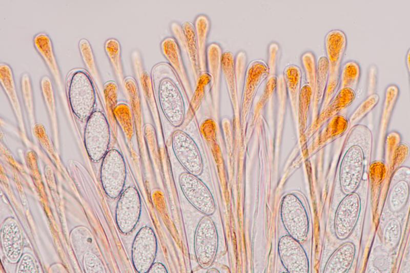 macrostoma
