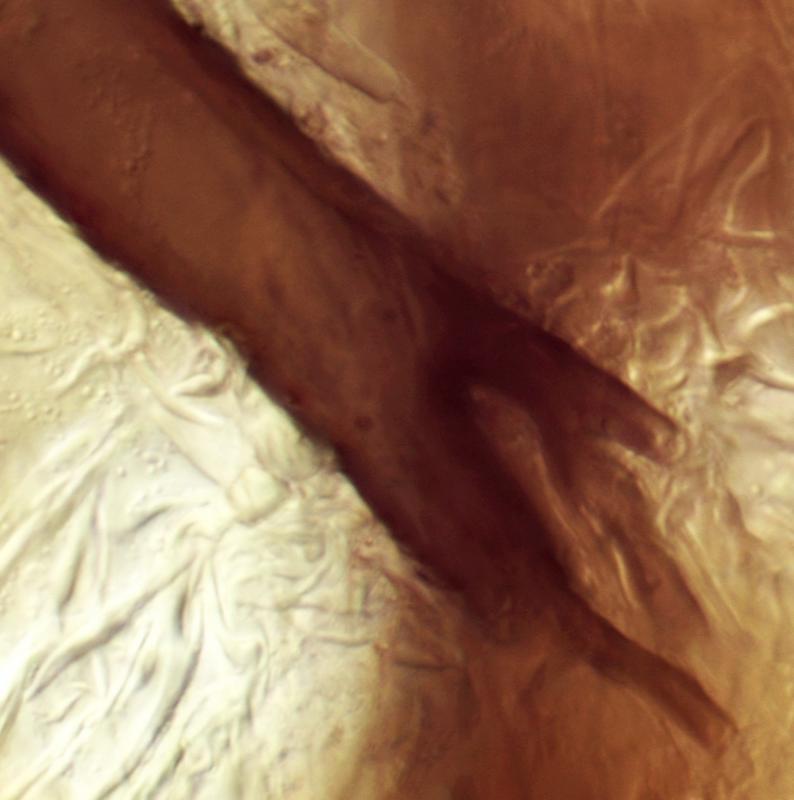 macrostoma
