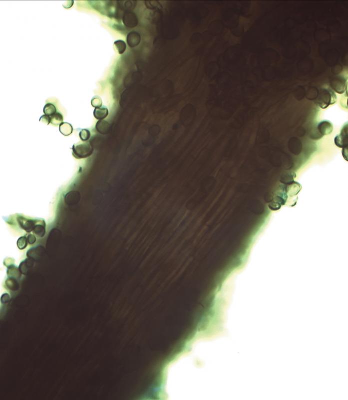 macrostoma