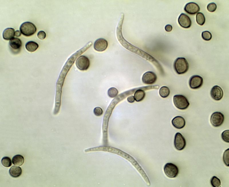 macrostoma