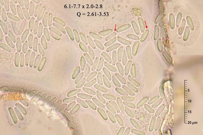 macrostoma