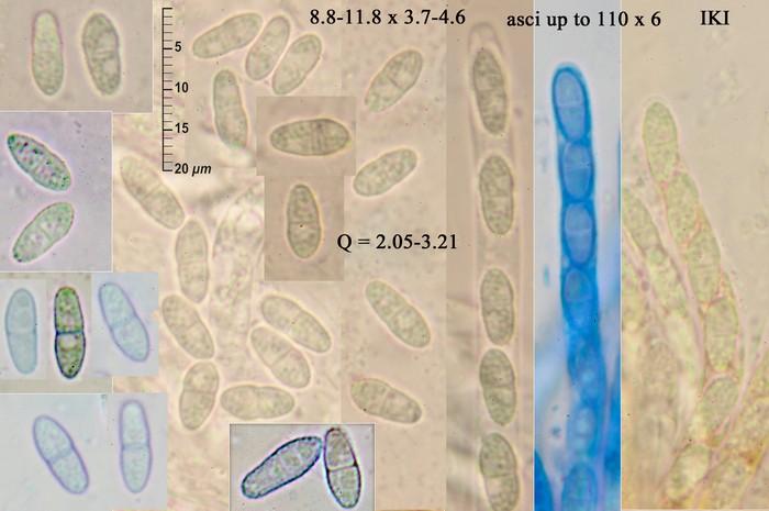 macrostoma