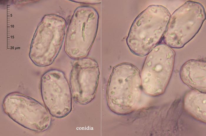macrostoma