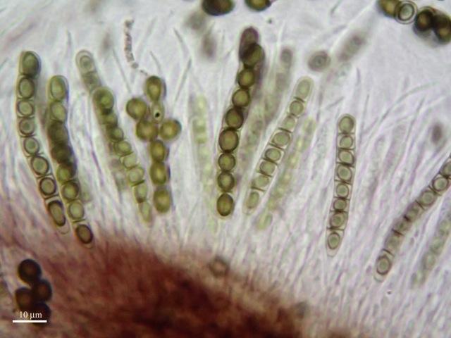 macrostoma