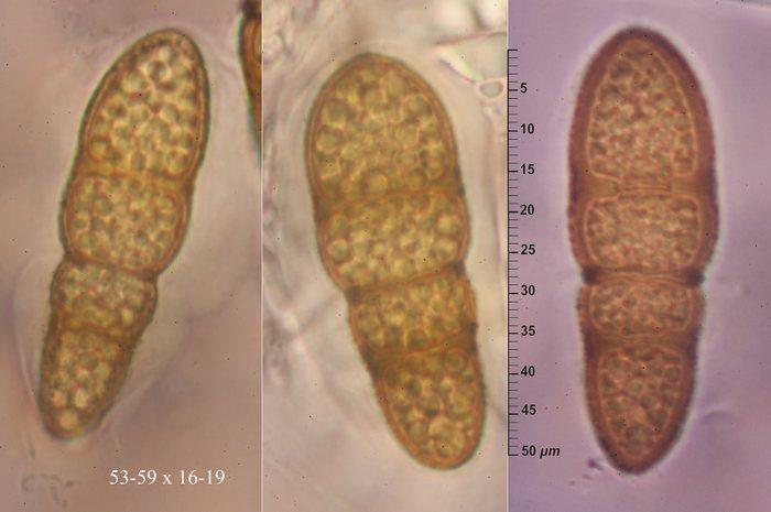 macrostoma