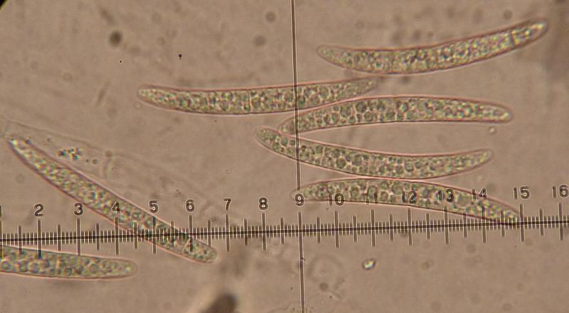 macrostoma