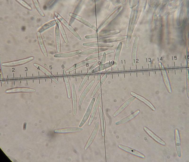 macrostoma