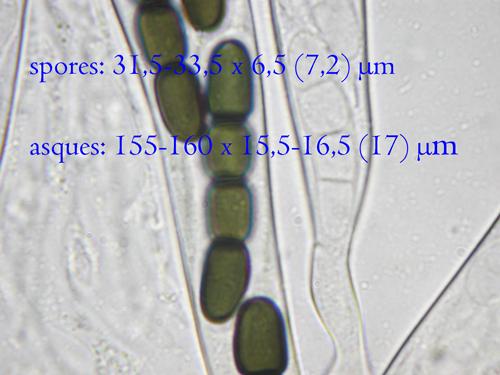 macrostoma