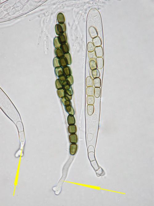 macrostoma