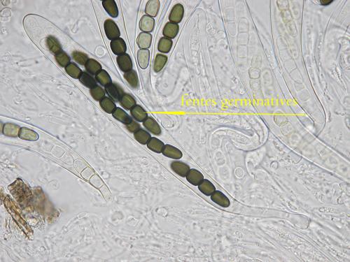 macrostoma
