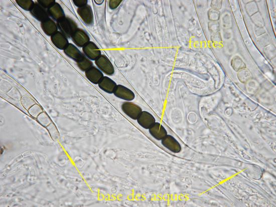 macrostoma