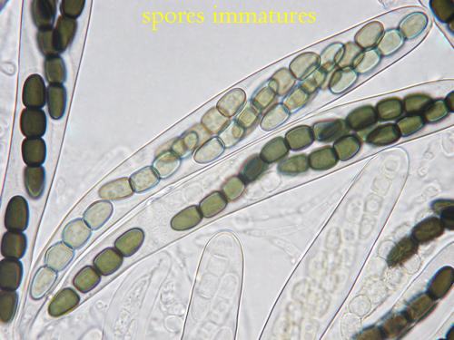 macrostoma