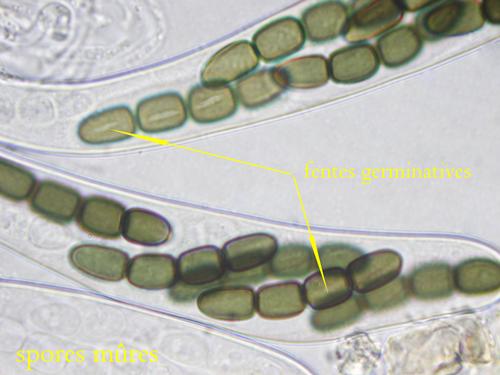macrostoma