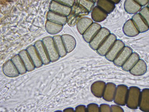 macrostoma