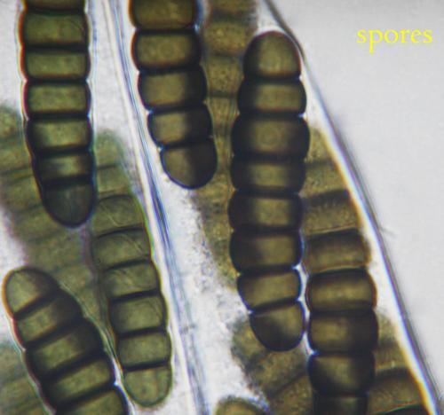 macrostoma