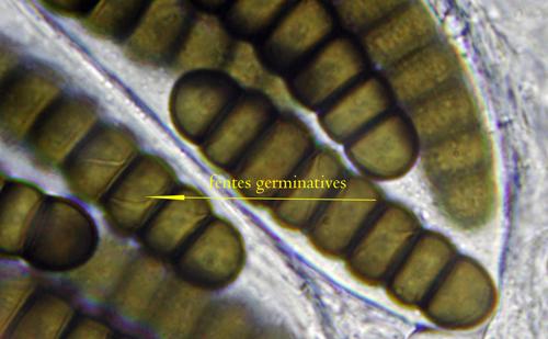 macrostoma