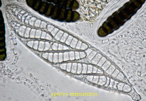 macrostoma