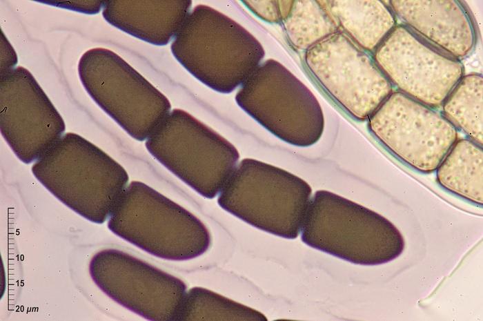 macrostoma