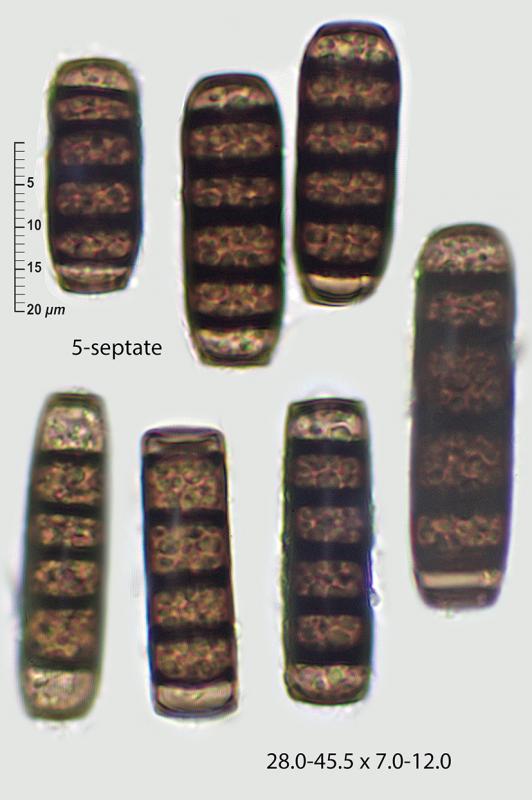 macrostoma