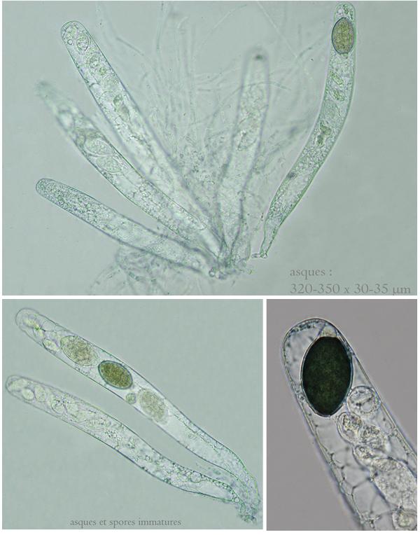 macrostoma