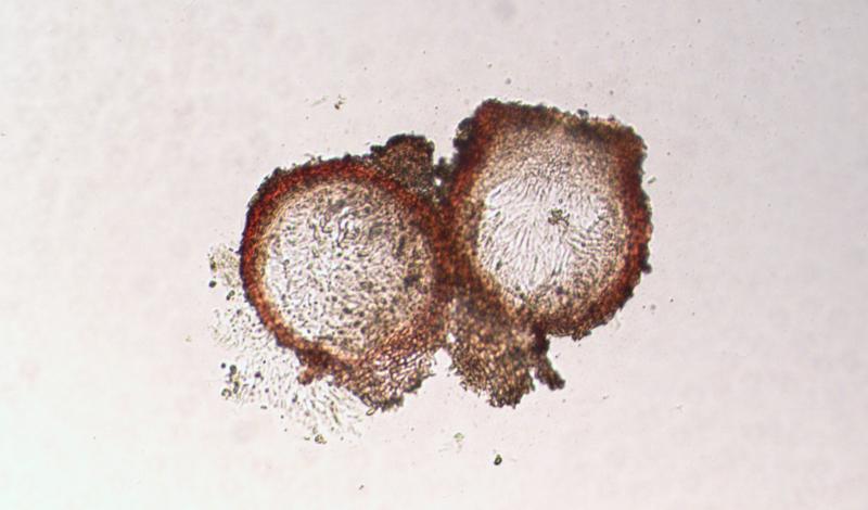 macrostoma