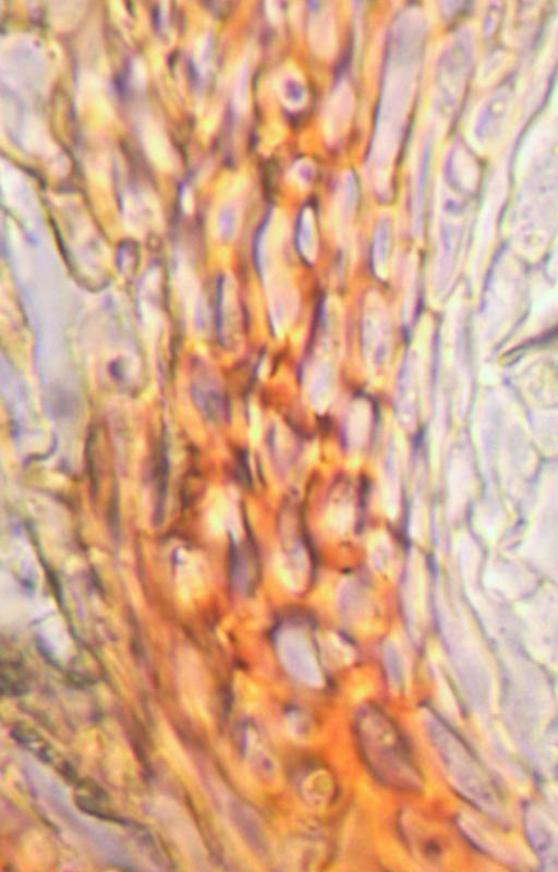 macrostoma