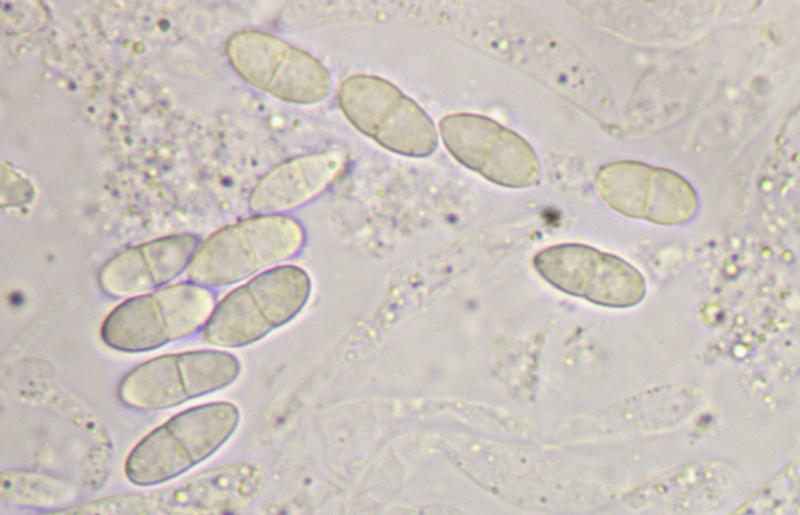 macrostoma
