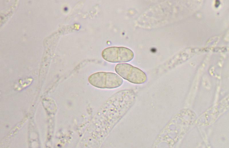 macrostoma