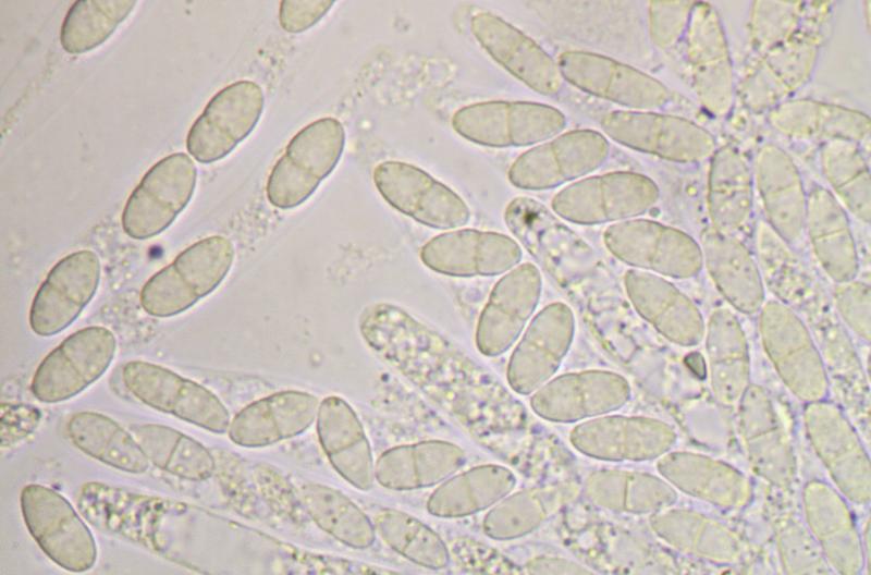 macrostoma