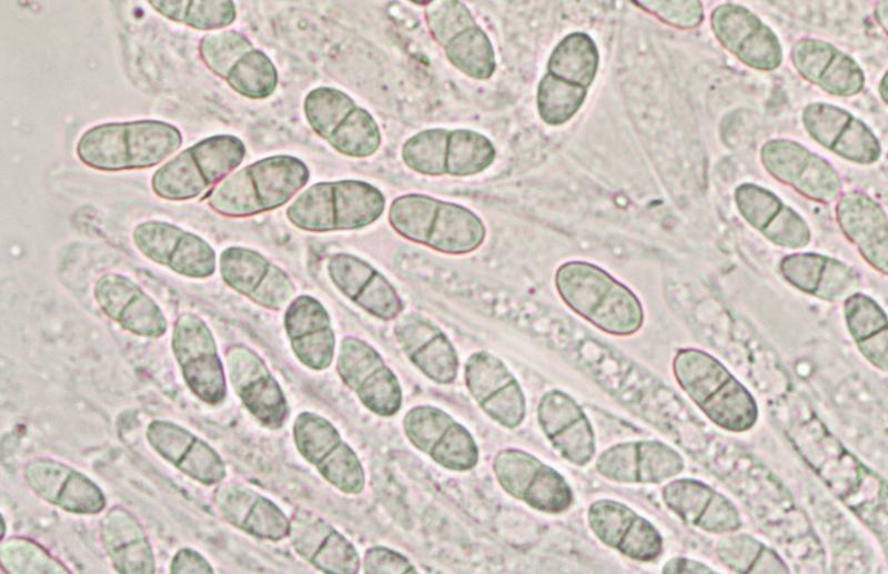 macrostoma